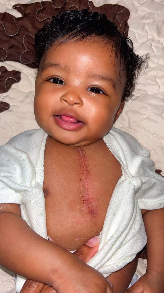 sadiafatma1278's tweet photo. Two weeks post surgery and look at this beauty 🥹🩷🙌🏾 https://t.co/dg4MS5p6VP