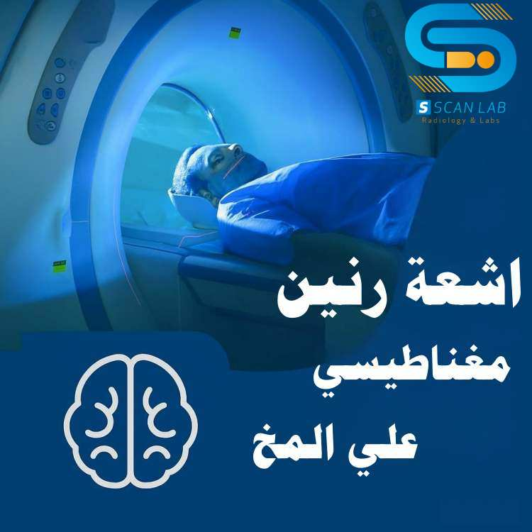 stokmarktt's tweet photo. انطفأت قناديلُ الماضي في رأسي، ولم يبقَ إلا صدىً لوجوهٍ لا أعرفُها وأسماءٍ تلاشت من ذاكرتي. أقفُ في منتصفِ الوجودِ بلا تاريخٍ، كأنَّ الزمنَ قد بترَ خيطَ حكايتي قبلَ أن تبدأَ. أنا الغريبُ الذي يرقبُ حياتَهُ من خلفِ زجاجٍ معتمٍ، باحثاً عن ذاتي في فراغٍ لا يرحم. https://t.co/20CjwraUFL