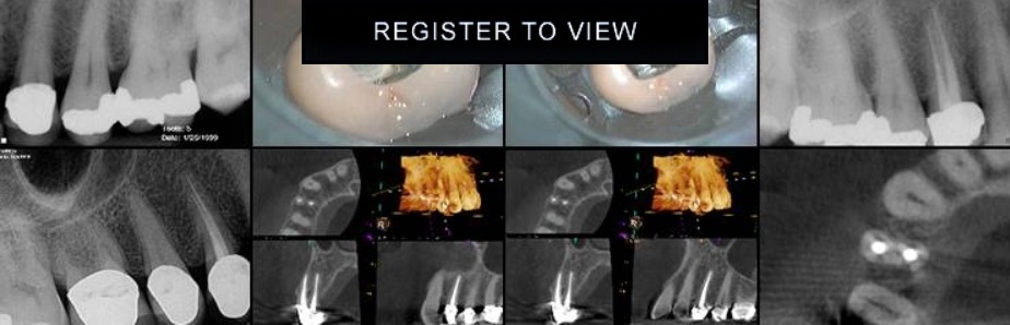 PureDentalLearn's tweet photo. Long Term Endodontic Results: What are We Achieving?
https://t.co/s95JViqXgO  #DrTerryPannkuk #puredentallearning https://t.co/n4Q8a7ax8d