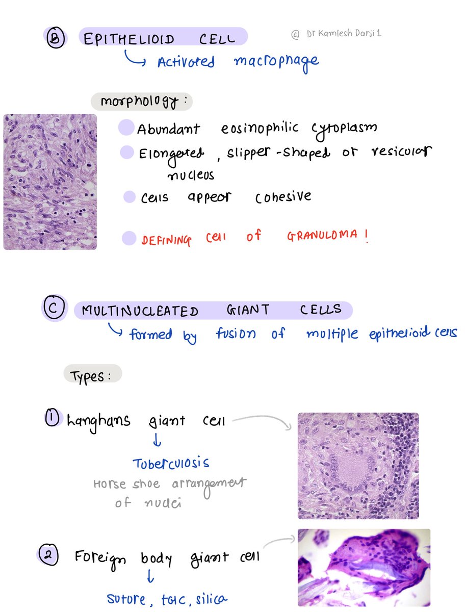 DrKamleshDarji1's tweet photo. Topic 14: Cells of chronic inflammation - 14/100 #Pathology #NEETPG https://t.co/Y0KP28q0uc