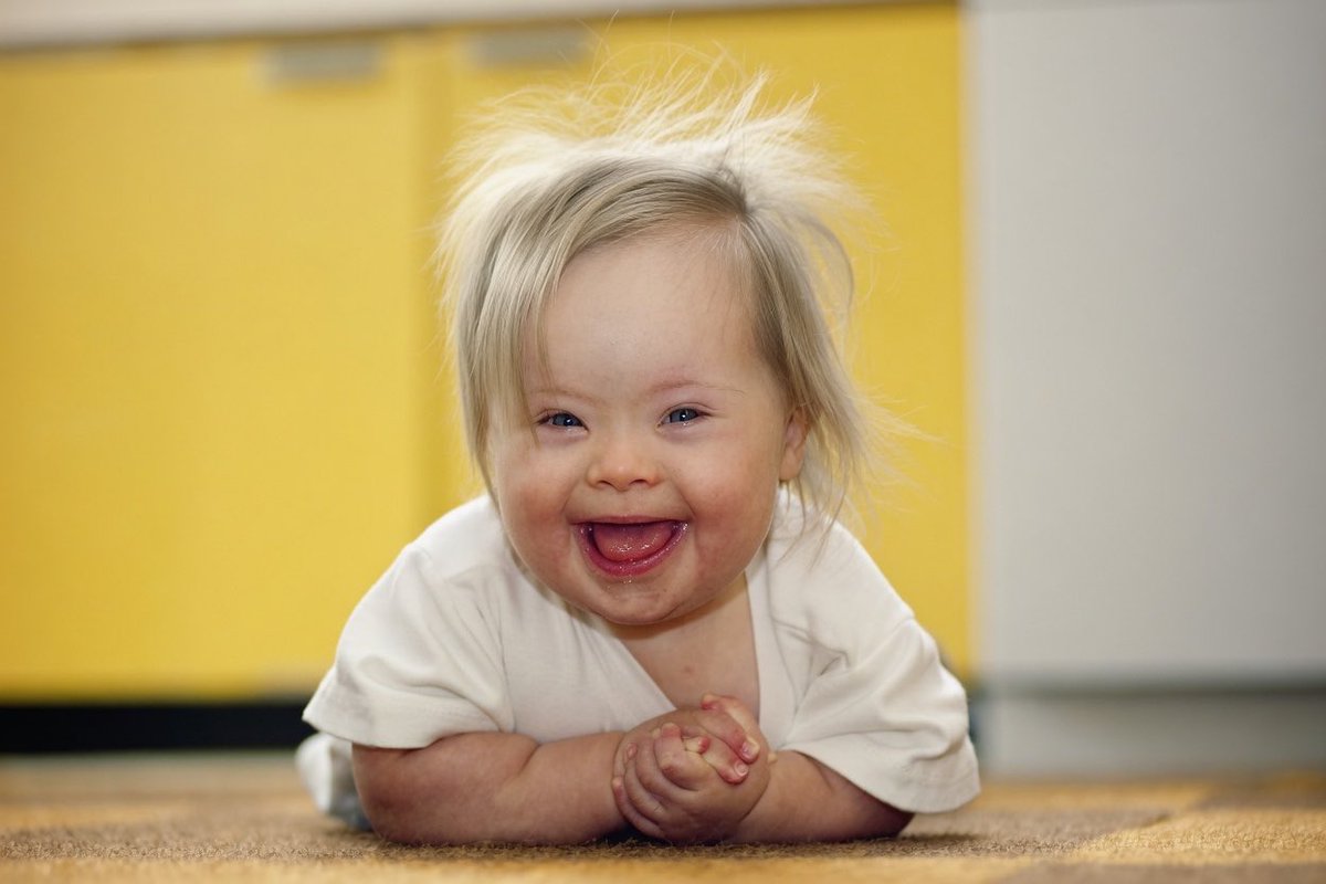 JonnyRoot_'s tweet photo. Every single child with Down syndrome is a gift from God, who deserves life.

These children have just as much value, and deserve life just as much as a child without DS.

Down syndrome children aren’t a curse to parents.

Pass it on. https://t.co/mPk2pk6sUC