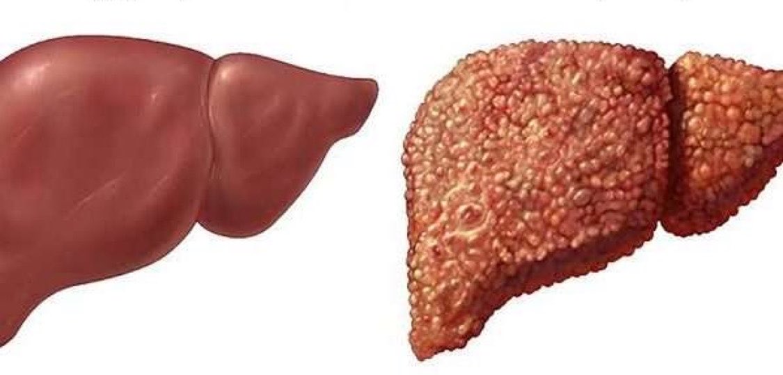 Manifest_Lord's tweet photo. 7 Early Signs That Might Indicate Your Liver Is Silently Starting to Fail

1: You suddenly wake up between 2 and 3 a.m. repeatedly. https://t.co/QZpaqCkJfk