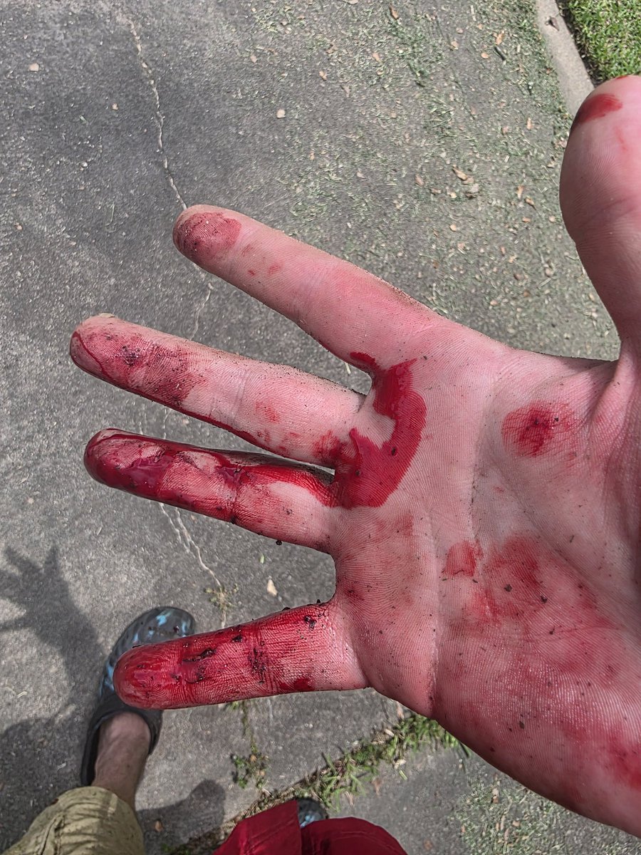 WDYM_SLEEP's tweet photo. Who knew rocks can bite? 😆 🤣 https://t.co/BTwhIi6PGC