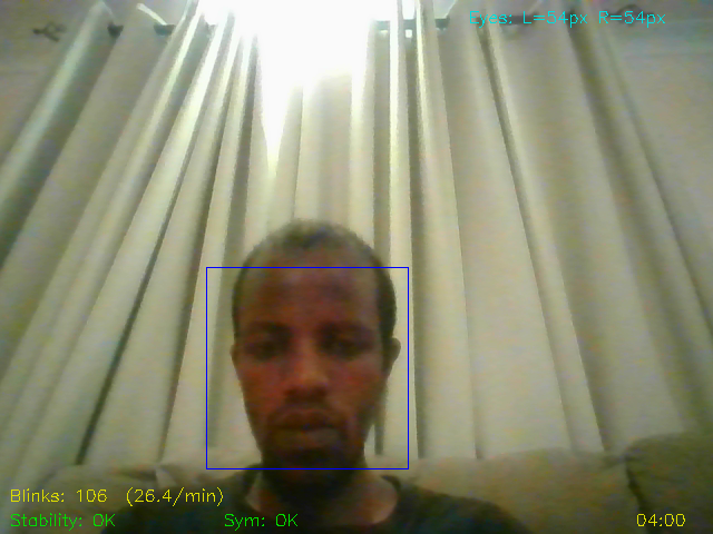 21givenchy's tweet photo. @ship_builders @nebiusai @composio @tavilyai @openclaw yoooo I build eyeLike

An OpenCV based webcam gaze tracker based on a simple image gradient-based eye center algorithm by Fabian Timm, extended with eye health monitoring, guided eye exercises, and session logging. https://t.co/UOJyiufmcm