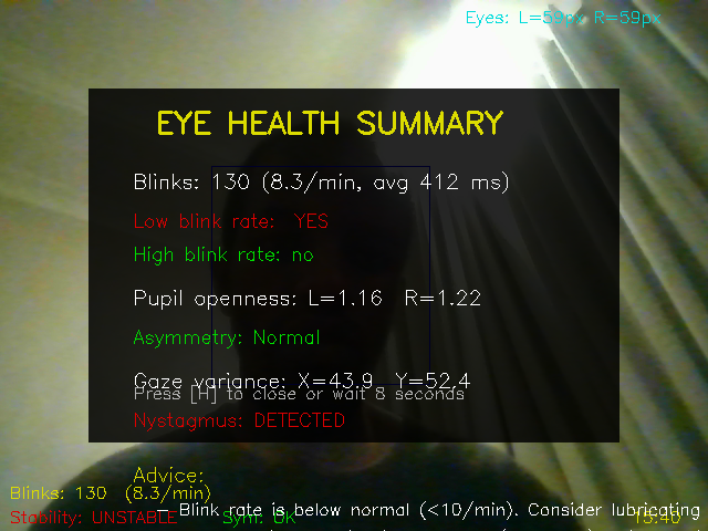 21givenchy's tweet photo. @ship_builders @nebiusai @composio @tavilyai @openclaw yoooo I build eyeLike

An OpenCV based webcam gaze tracker based on a simple image gradient-based eye center algorithm by Fabian Timm, extended with eye health monitoring, guided eye exercises, and session logging. https://t.co/UOJyiufmcm