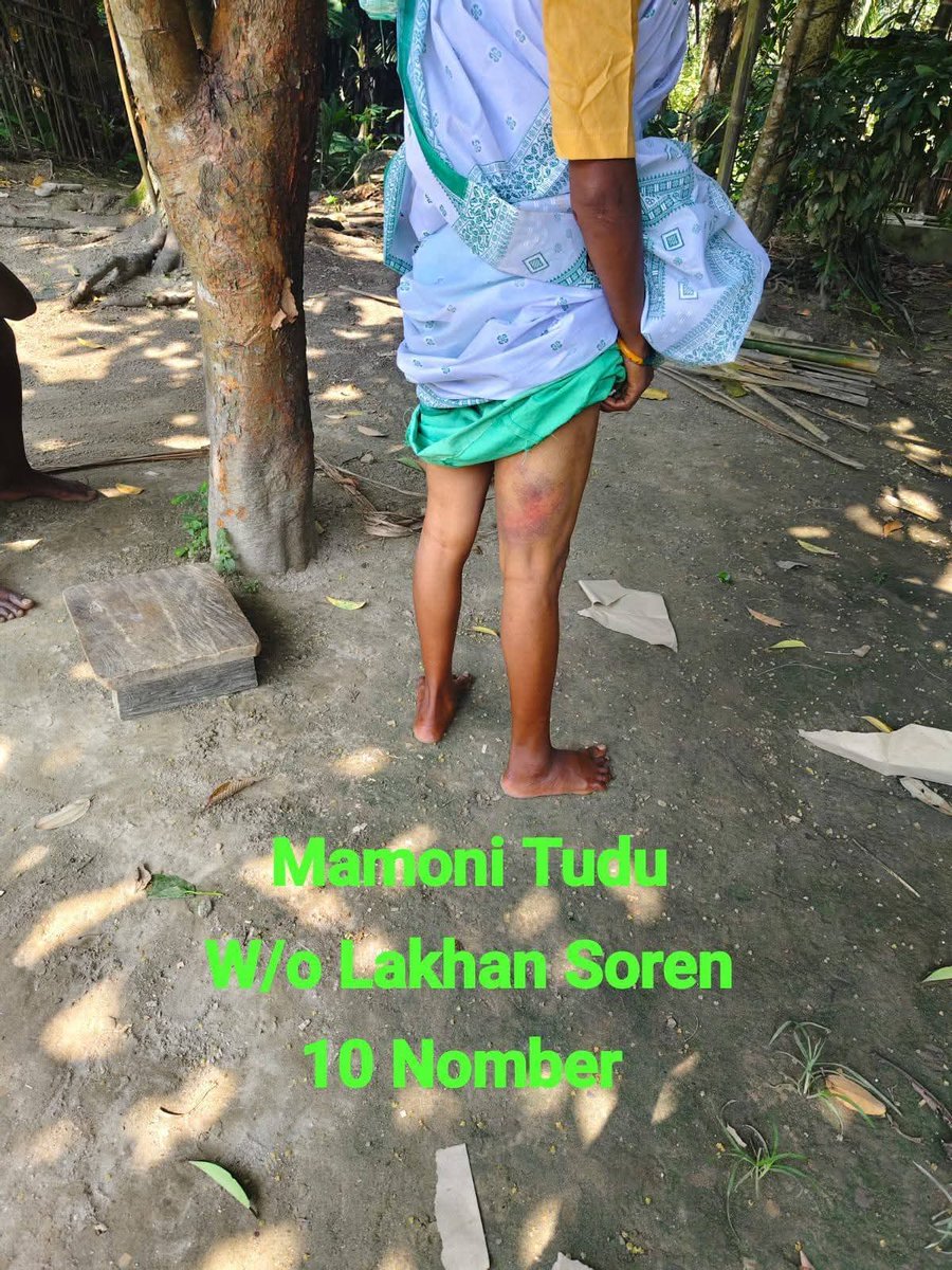 PulakDa09473058's tweet photo. On 1 June 2026, a family in Mazbat, Udalguri, Assam was reportedly brutally assaulted by a group of Christi@n... for refusing to convert to Christianity...
#StopConversion
@assampolice @udalguripolice please look into this matter...! https://t.co/9O3ZRfJ0xK