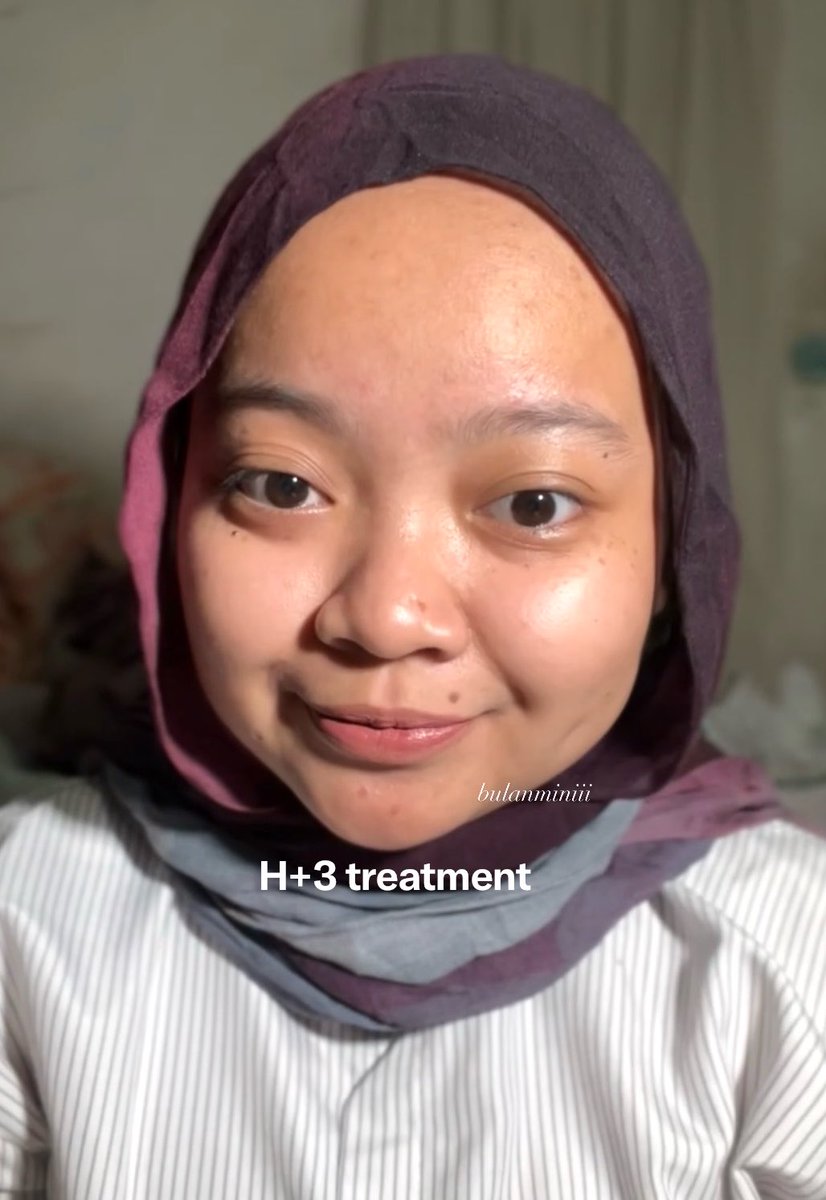bulanminiii's tweet photo. MAAF NORAK!

in this economy ga nyangka treatment DNA Salmon 300ribuan bisa bikin kulit glowing satset 😭😭😭 https://t.co/Vv96hk5OV3