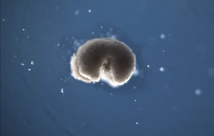ampariho's tweet photo. A third state beyond life & death?Cells from dead organisms can reassemble into multicellular biobots (Xenobots & Anthrobots), which move, heal & could soon transform medicine by:
_Delivering targeted drugs 💊 _Regenerating damaged tissue _Clearing blocked arteries 🩺
#biobots https://t.co/TJYZkxDbYF
