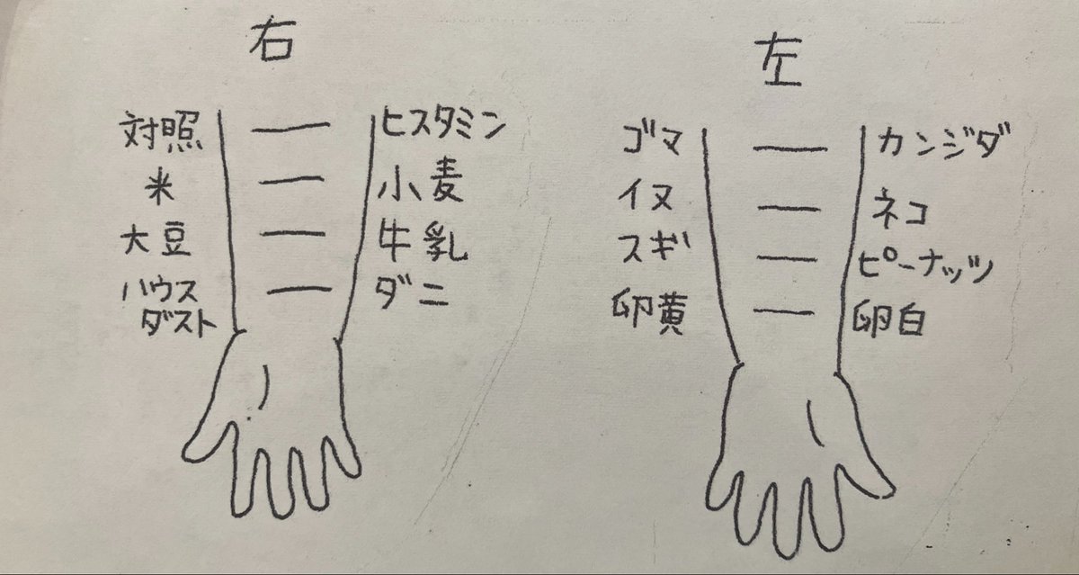 hottokenaii's tweet photo. 【悲報】弊ﾍﾞﾋﾞ、卵アレルギー確定

パッチテストで判定。
他の項目は全てクリア！

同じく出た友達は、ちゃんと2ヶ月遅れで卵始めて大丈夫だったそう。離乳食開始前にアレルギー分かって少し安心。

引用元の母子栄養協会さんと同じく先生も、離乳食は6ヶ月での開始でいいって言ってた🙂‍↕️ https://t.co/5CfA4qfuSv