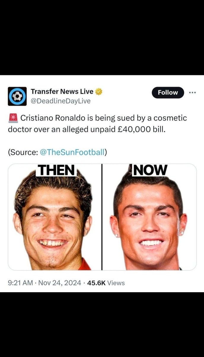ThisIsGK10's tweet photo. @CristianoXtra_ The reason why idolo looks so young 😭 https://t.co/7oB6VVX6bk