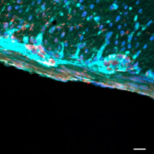 jclinicalinvest's tweet photo. Revealing a potential approach for diet-induced #GutMotility disorders: https://t.co/ZoSkEpYz3l
Shanthi Srinivasan & team @EmoryMedicine find the #WesternDiet triggers iron-driven neuronal death in the gut—and targeting ferroptosis restores enteric function in mice.
The figure shows colon tissue sections from mice treated with AAV-Nfe2l2 with sustained upregulation of total Nfe2l2 protein (red) in enteric neurons, with strong co-localization with the neuronal marker TUBB3 (blue).