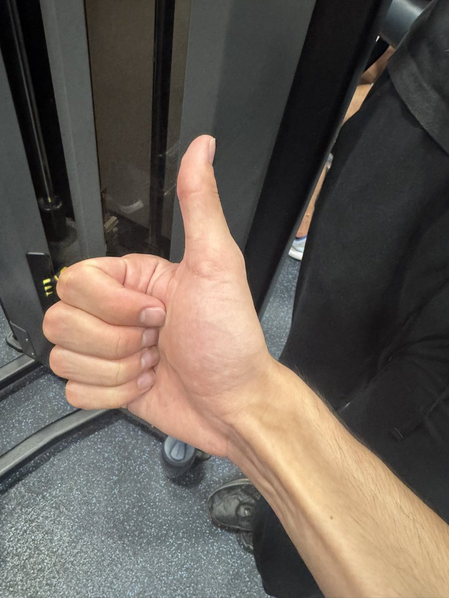 Gunrunner2003's tweet photo. @RhodesianFur @Krieg_Tortoise My palms white, do I get the W word pass? https://t.co/BKj9bt1Sw2