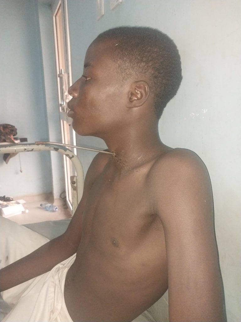 MuhammedSanity's tweet photo. Bashir Yana neman agajin gaggawa sakamakon soka mashi Karfe a wuya da masu kwacen waya sukayi masa a U/Kanawa, Nan take @B_ELRUFAI ya aika da kudin aikin don ayi mashi aiki.(Emergency Surgery).

Sannu da kokari JAGORA 
Allah yabiya Ka 

Bello Dai 2027 Ba chanji Da Yardar Allah https://t.co/hl7wuORx66