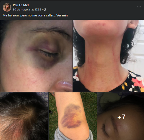 EnSerioNoticias's tweet photo. 🚨💜 #Morelos | "YA NO ME VOY A CALLAR"; MUJER EXHIBE PRESUNTO CASO DE V10L3NC14 FAMILIAR EN REDES 👀
 Paula realizó una denuncia pública a través de redes sociales, donde acusa a su exesposo, Jorge Francisco Rabadán Torres, de presuntos actos de v10l3nc14 familiar. https://t.co/gSvUhrlpEl