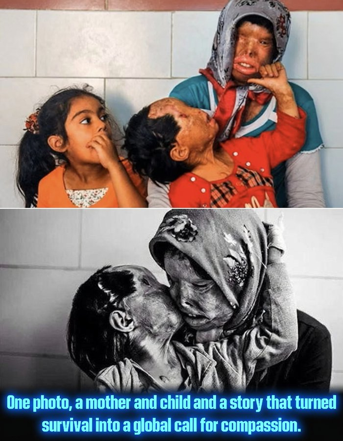RobertoAvventu2's tweet photo. QUESTO E' VERO PATRIARCATO!

Alcune storie non hanno bisogno di esagerazioni. Devono solo essere raccontate con onestà e delicatezza. Questa è la storia di Somayeh Mehri, una giovane madre iraniana che nel 2011 trovò il coraggio di lasciare un matrimonio segnato dalla paura e dal controllo, un passo che molti sognano ma che pochi si sentono abbastanza sicuri da compiere. La sua decisione fu accolta con una violenza inimmaginabile. Nel giugno di quell'anno, il marito aggredì Somayeh e la sua figlia di tre anni, Rana, con l'acido, nel tentativo di metterle a tacere e distruggerle. Ma fallì. Sopravvissero. Somayeh perse la vista. Rana perse parte della sua. Eppure la crudeltà non riuscì a spezzare il loro legame, la loro dignità, né la loro voglia di vivere.