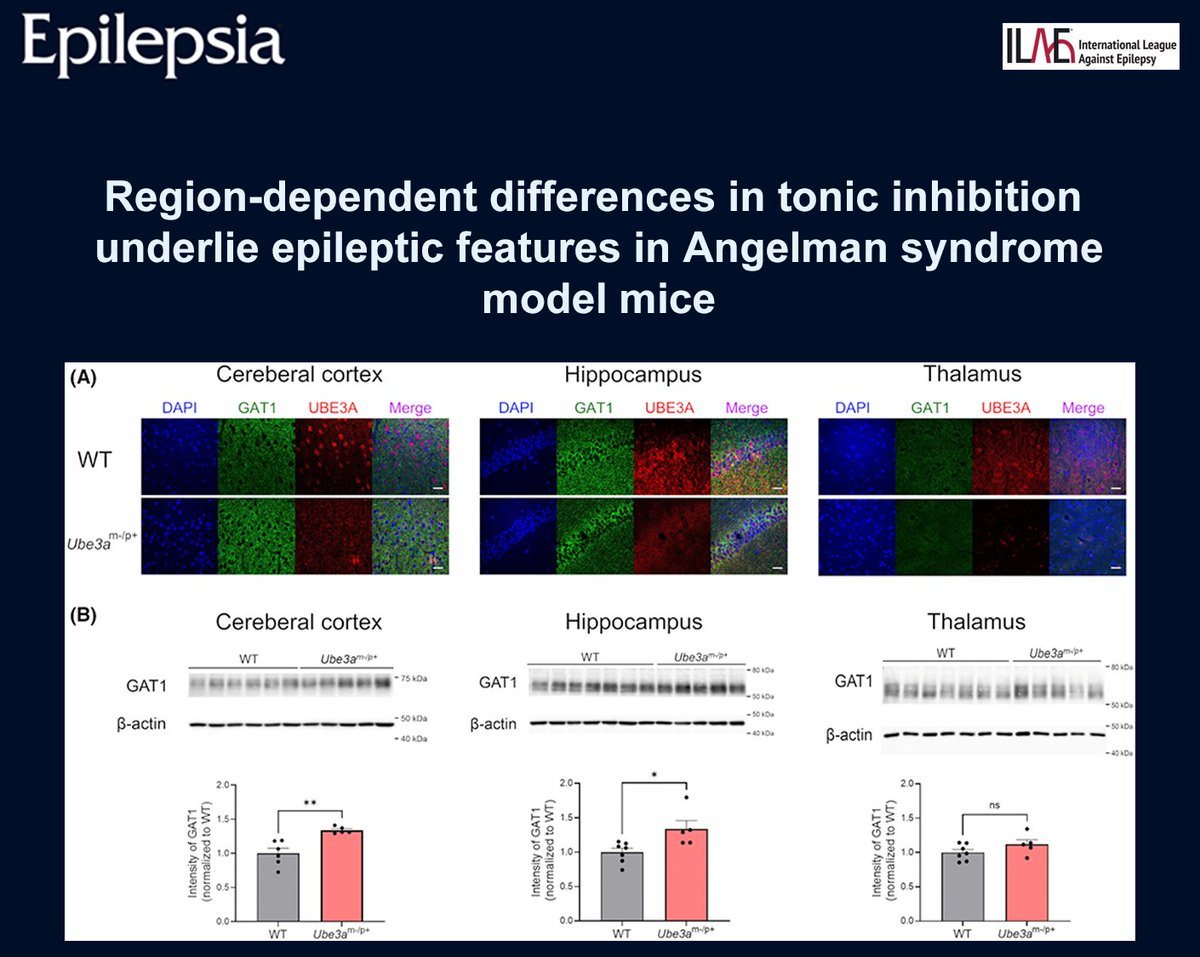 EpilepsiaJourn's tweet photo. Tonic inhibition is reduced in cortex and hippocampus but preserved in thalamus in a mouse model of Angelman syndrome.
https://t.co/VaFDHrNbqZ

#epilepsy #ilae #epilepsiajourn #EEG #GABAAreceptors #mousemodel #neurodevelopmentaldisorders #tonicinhibition https://t.co/cfL49nGKUB