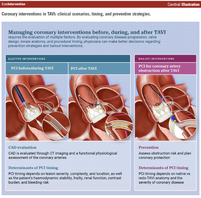 EuroInterventio's tweet photo. From coronary physiology and PCI timing to coronary re-access and coronary obstruction prevention, this State-of-the-Art review provides practical guidance for managing coronary interventions in patients undergoing TAVI.

🔗https://t.co/SjF9384oBS

#TAVI #CoronaryInterventions #StructuralHeartDisease

@GilbertTangMD @didier_tchetche @barbanti_marco @AnderRegueiro @nicolo_piazza
@G_Tarantini01