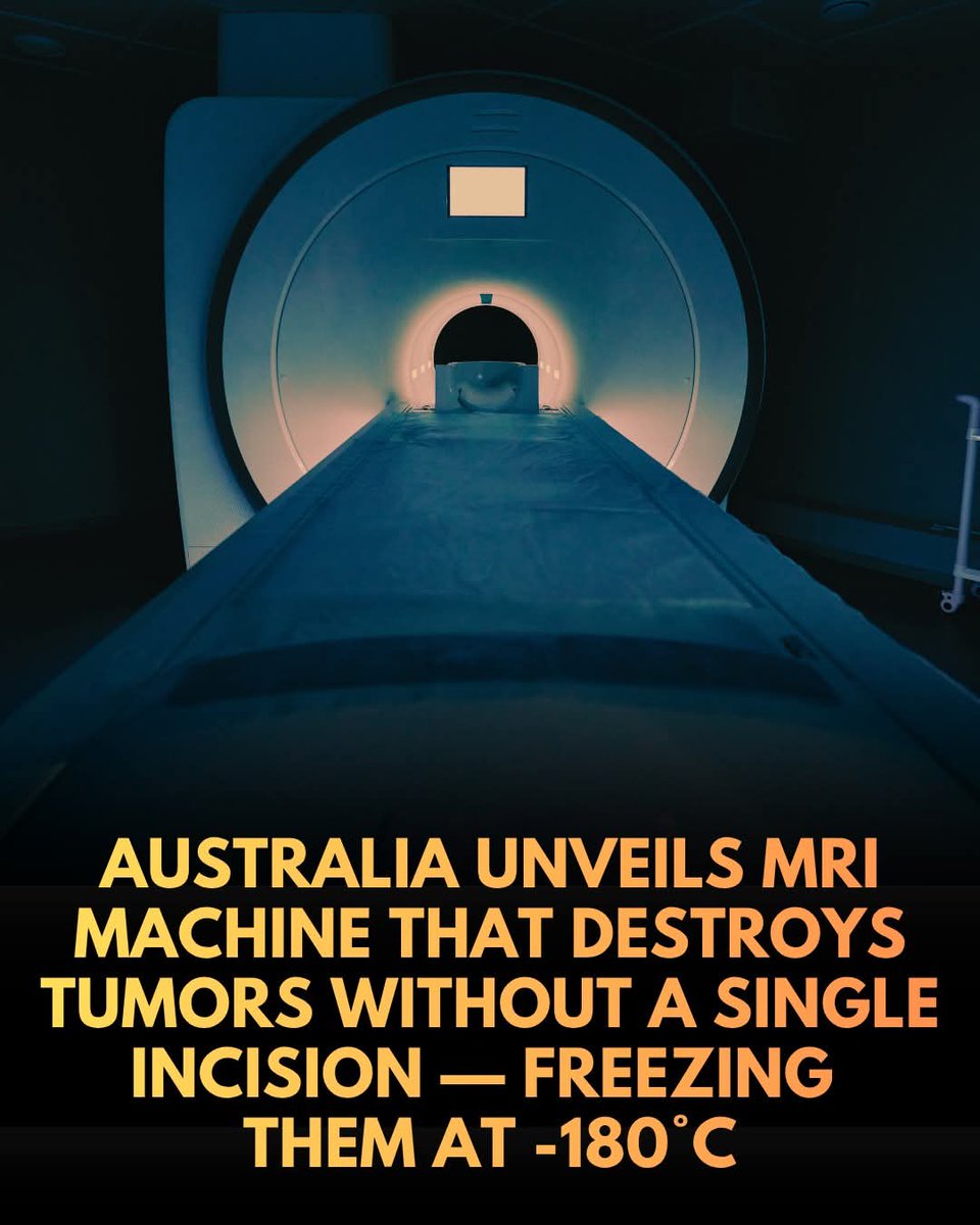 ShiningScience's tweet photo. A hospital in Australia is using a new MRI technology that can eliminate certain tumors without a single incision.

No surgery required. 

Doctors at Liverpool Hospital in Sydney have introduced the country's first dedicated MRI-guided cryoablation system, allowing specialists to destroy localized tumors by freezing them into what are essentially tiny iceballs inside the body.

The procedure works by inserting ultra-thin needles directly into a tumor while doctors track every movement in real time using high-resolution MRI imaging. Once in position, compressed argon gas rapidly cools the probe tip to an astonishing -180°C, freezing the tumor from the inside out. 

The extreme cold ruptures cancer cells, cuts off their blood supply, and destroys the targeted tissue.

What makes the technology especially powerful is its precision. Because doctors can continuously monitor the growing iceball on MRI scans, they can ensure the tumor is destroyed while avoiding damage to nearby structures such as nerves, bones, the spinal cord, kidneys, or liver.

For many patients, the treatment could offer a far less invasive alternative to major surgery. Traditional procedures for tumors near the spine or other sensitive areas can require extensive operations, implanted hardware, lengthy hospital stays, and months of recovery. MRI-guided cryoablation can often be completed in a single day, with patients returning home just hours later.

Doctors say the technology could transform how certain cancers and painful tumor-related conditions are treated, marking a major step toward a future where highly targeted therapies replace many conventional surgical procedures.

source: S. Kumar. “New MRI Machine In Sydney Can Freeze Tumours, Reduce Pain In Patients.” (May 2026). NDTV.