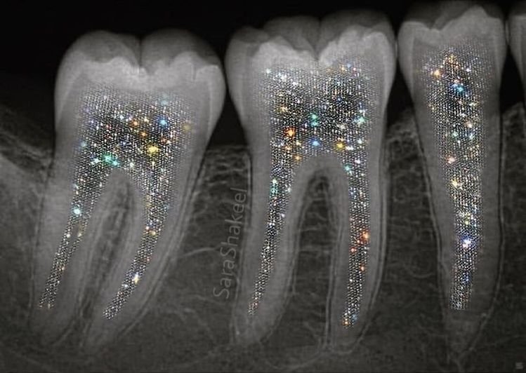 fascinatingonX's tweet photo. 🚨JUST IN: Japan trials new drug that regrows human teeth ─ ending dentures and implants forever https://t.co/4ZqzjmAE3a