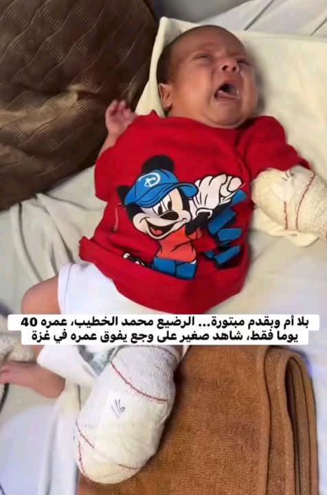han_moh7's tweet photo. طفل من غزة يبكي وجعاً بلا أم يتيم الأم وبقدم مبتورة .. الرضيع محمد، عمره 40 يوماً فقط، وبات جسده الصغير شاهداً على وجع أكبر من أن يُروى لهذا العالم الظالم قبل أن يخطو أولى خطواته .. لعن الله الاحـ..ـتلال بعدد أنفاس البشر وكل من عونهم يارب ..🤲😱😭💔💔🔻

#انقذوا_اطفال_غزة https://t.co/zi61tc9iZN