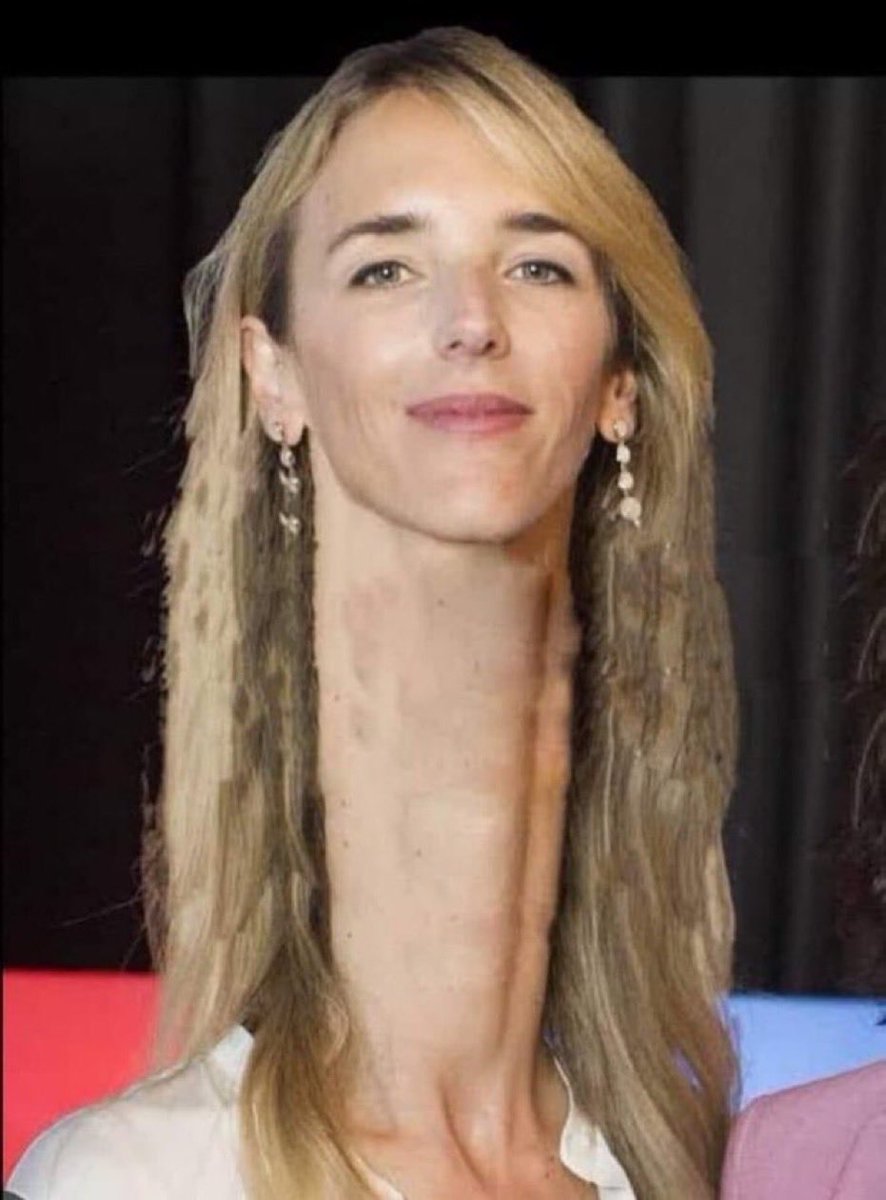 GUSI_ESESOYYO's tweet photo. Por mentirosos a algunos les crece la nariz, a otros las orejas y a esta; le creció el cuello.
@IdiazAyuso 

Jajaja la cuello largo jajaja https://t.co/DHzIaZ8oi3