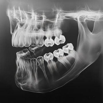 IdeaBravaX's tweet photo. 🚨: Japón prueba nuevo fármaco que regenera dientes humanos ─ poniendo fin a las dentaduras postizas y los implantes para siempre https://t.co/SrZSD2L0eZ