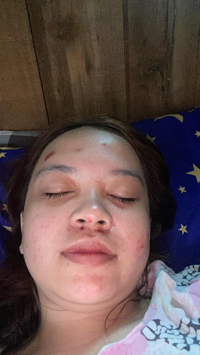 nothappypeople1's tweet photo. udah seminggu lebih nih ga jalan https://t.co/AKCu1mjEJP