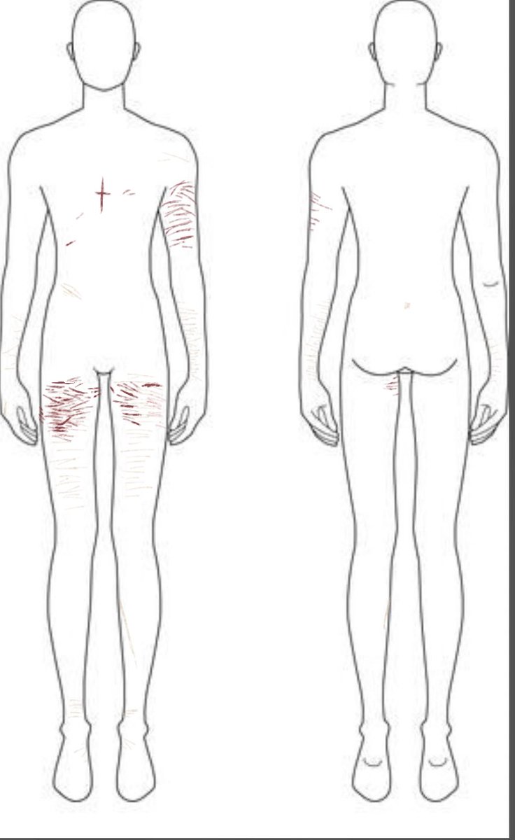 zva101784's tweet photo. how my body looks like noww
#shtwt https://t.co/3ZGG6EhNpV