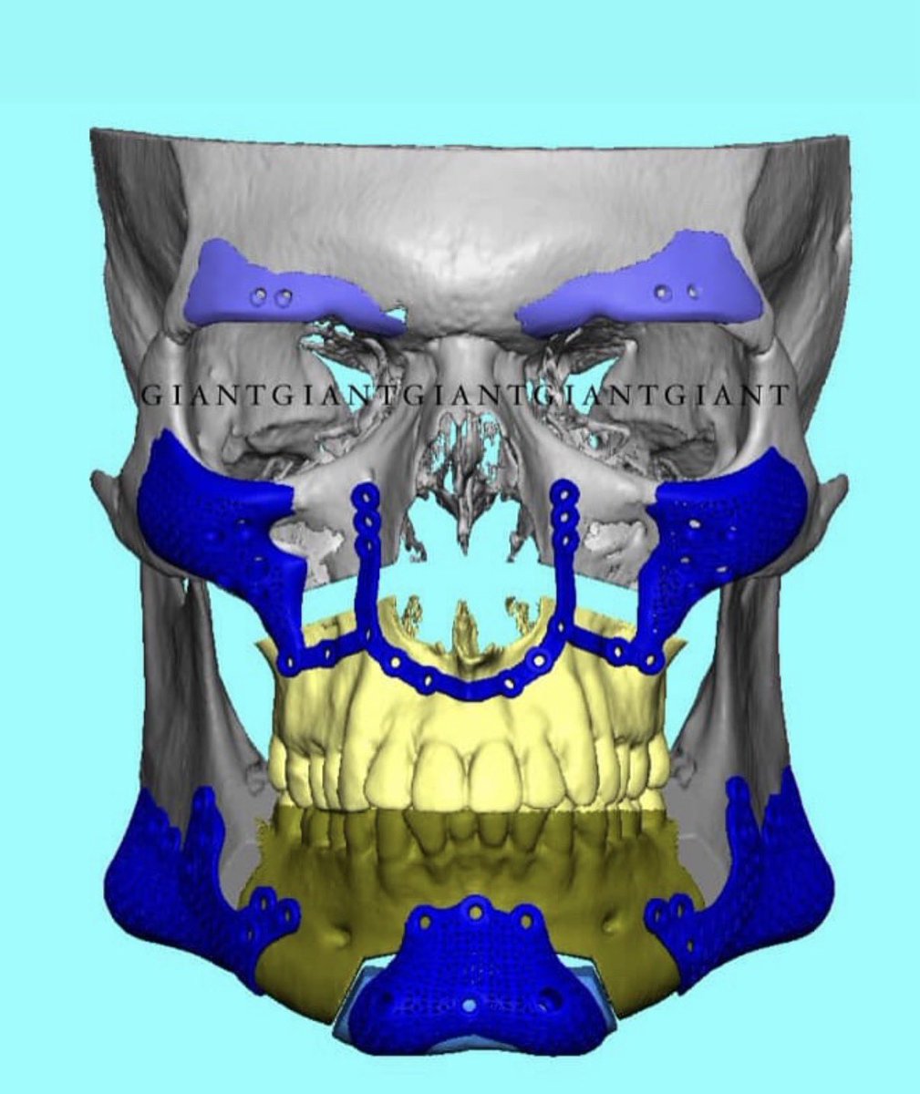 Clavicular Updates tweet media
