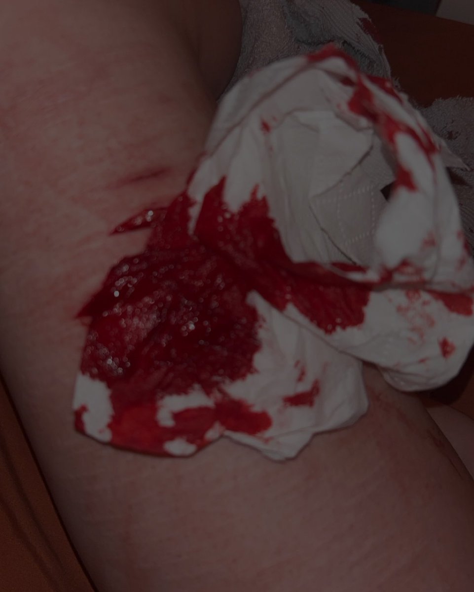elisgluttony's tweet photo. said I wasn’t cutting tnt but I had to test out the new razors lol 

#shttw #shedtwt #slicetwt #ouchietwt #beanstwt #styrotwt #goretwt #alctwt https://t.co/i9j0UDR79C