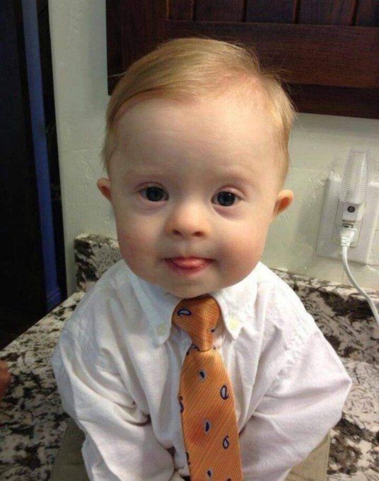 JCharrasqueado_'s tweet photo. Este niño, con síndrome de Down, es valioso y digno de vida. https://t.co/YuWmPewFcL