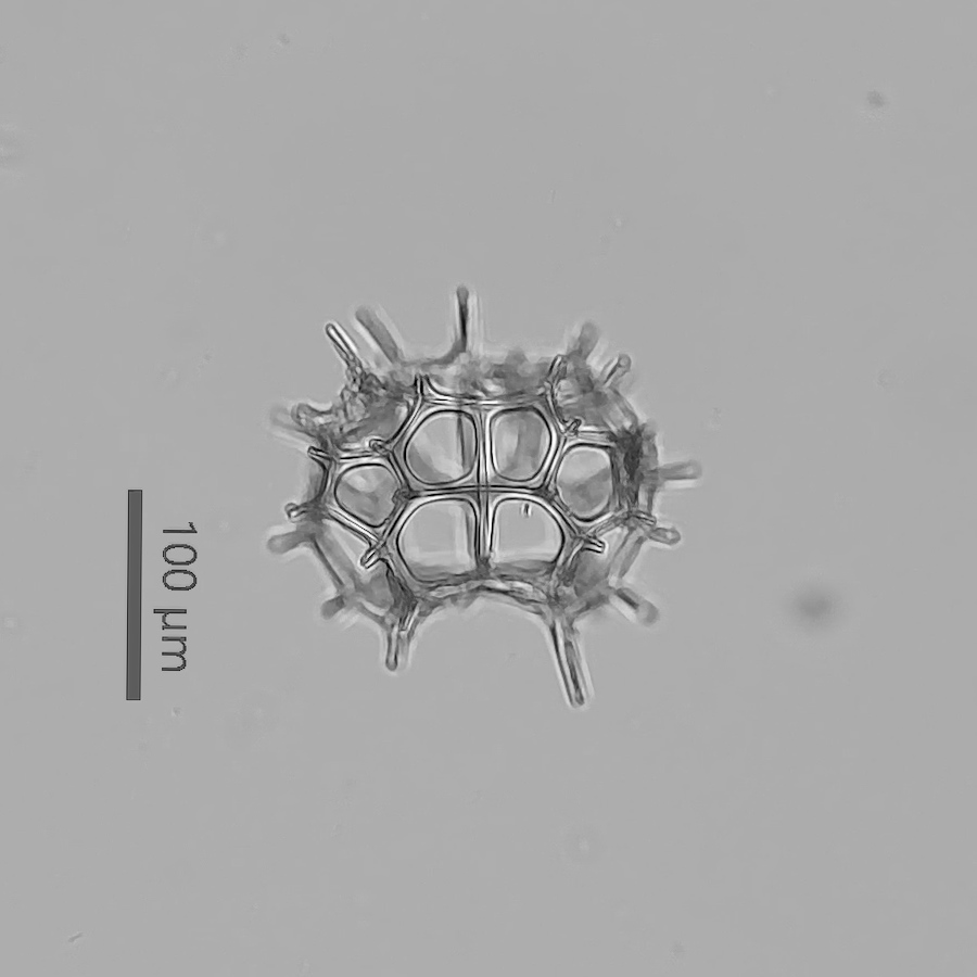 microscope61's tweet photo. RC GEARさんからいただいた鴨川のコンクリーション中の放散虫その３。１枚目はOmmatartus terathalamus tetrathalamus、２枚目はCeratospyris polygona、３枚目はRhodospyris？、４枚目はZygocircus buetschli？ 私は素人なので名称は間違っている可能性大です。#放散虫の日 https://t.co/wACAnW5CHh