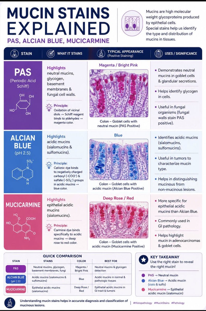 thejourneymate's tweet photo. Mucin Stains Explained 🔬

(c): Dr Rakesh Kumar https://t.co/fGW64VVjZZ