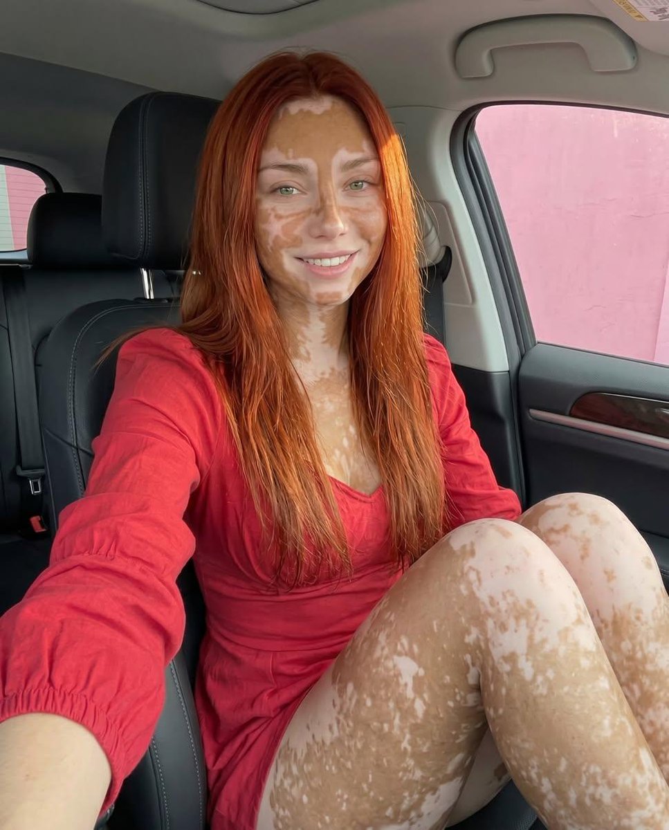 AnitaParve57846's tweet photo. Am I actually pretty? https://t.co/3Bs9YtiwVR