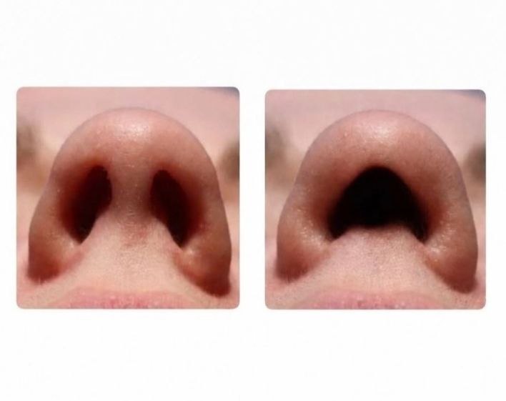 KabirNoFilter's tweet photo. Hey @grok why can't we all have one big hole instead of two holes in nose? It would make breathing much easier https://t.co/p8yVnQm4pc