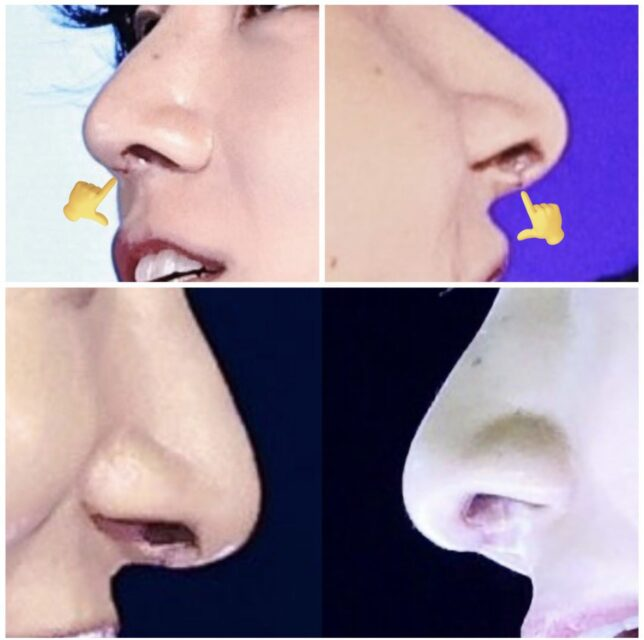 luvRiri's tweet photo. The real plastic: https://t.co/5QYqXnBqMG