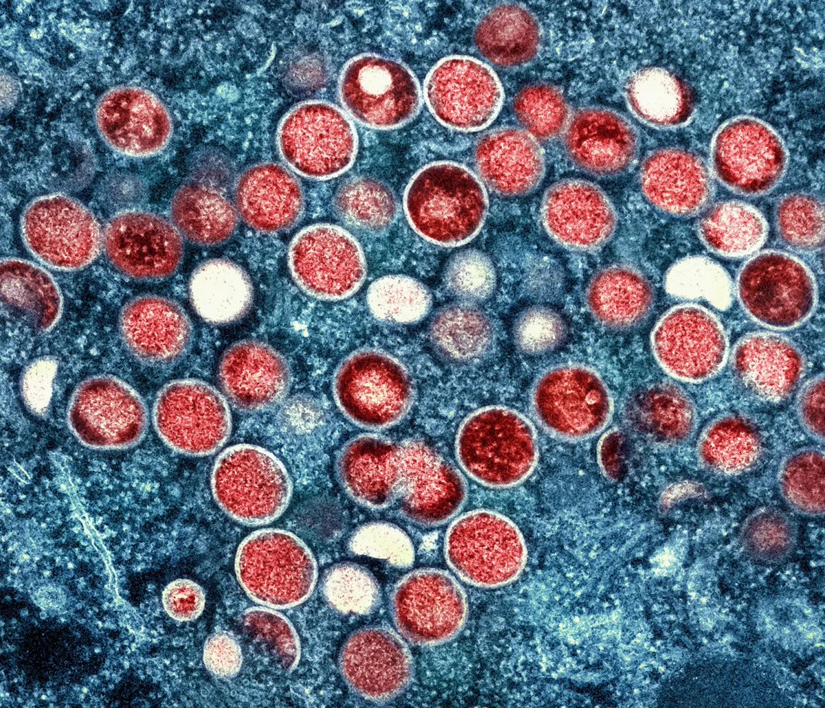 Kekius_Sage's tweet photo. JUST IN: Two scientists at a US government laboratory were accused of transporting biological threats across continents.

Secretly stuffing 113 vials of the mpox virus into their luggage were two Biosafety Level 4 experts: Montana lab chief Vincent Munster and his associate Claude Kwe.

They carelessly boarded a crowded commercial flight from the Congo epicenter, where the outbreak has claimed over 2.000 lives. Upon landing in the United States, they blatantly lied to US Customs to bypass security.

A five year prison sentence and a $250.000 fine are now on the line. This shocking breach shows just how easily a bio disaster could start.