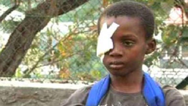 ContreAttaque_'s tweet photo. Nassuir Oili, éborgné à Mayotte par un gendarme, à l'âge de 9 ans. https://t.co/yfJUumJXba