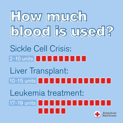 RedCrossNCGC's tweet photo. You may never know if you're helping a new mom, a person fighting cancer, a Sickle Cell Warrior or a patient recovering from surgery. But by giving blood, you can make a life-changing difference for someone up to 6 times a year.
Make an appointment today: https://t.co/XM0b1vqzwY https://t.co/cs20SsSj8j