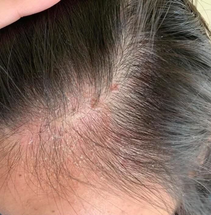 sinderclass's tweet photo. baru sadar ternyata shampoo itu bukan cuma buat bersihin rambut, tapi yg lebih penting justru buat ngerawat kulit kepala 😳

soalnya kalau scalp sehat, rambut juga bakal lebih terawat dari akarnya loh, bener gak? https://t.co/auunR7yUl9