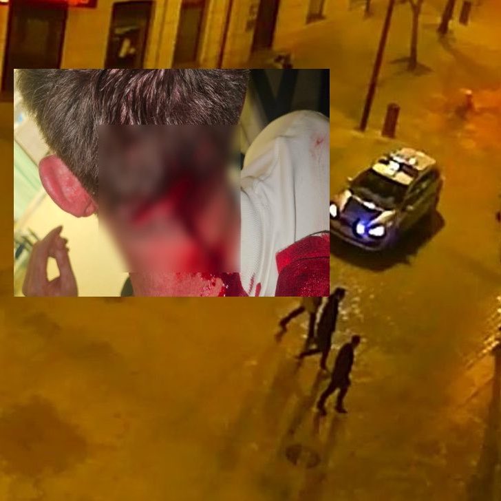 visegrad24's tweet photo. “I don't understand the leniency shown to a foreign criminal,” says conservative MP @Michal_Moskal after a shocking attack by a Zimbabwean in Poland.

The Warsaw-based Zimbabwean DJ who brutally attacked a Pole in a bar in the city of Lublin on Sunday morning with a beer glass, resulting in multiple stitches and a spinal cord injury, has been treated with extreme leniency by Polish police and will not be deported from Poland.

MP @Michal_Moskal has announced that he has filed a parliamentary intervention with the Lublin City Police Commander demanding explanations, which he will present to the public.

He is in the process of submitting an interpellation on this matter to the Ministry of Interior. 

Pictured: the injury caused by the brutal attack.