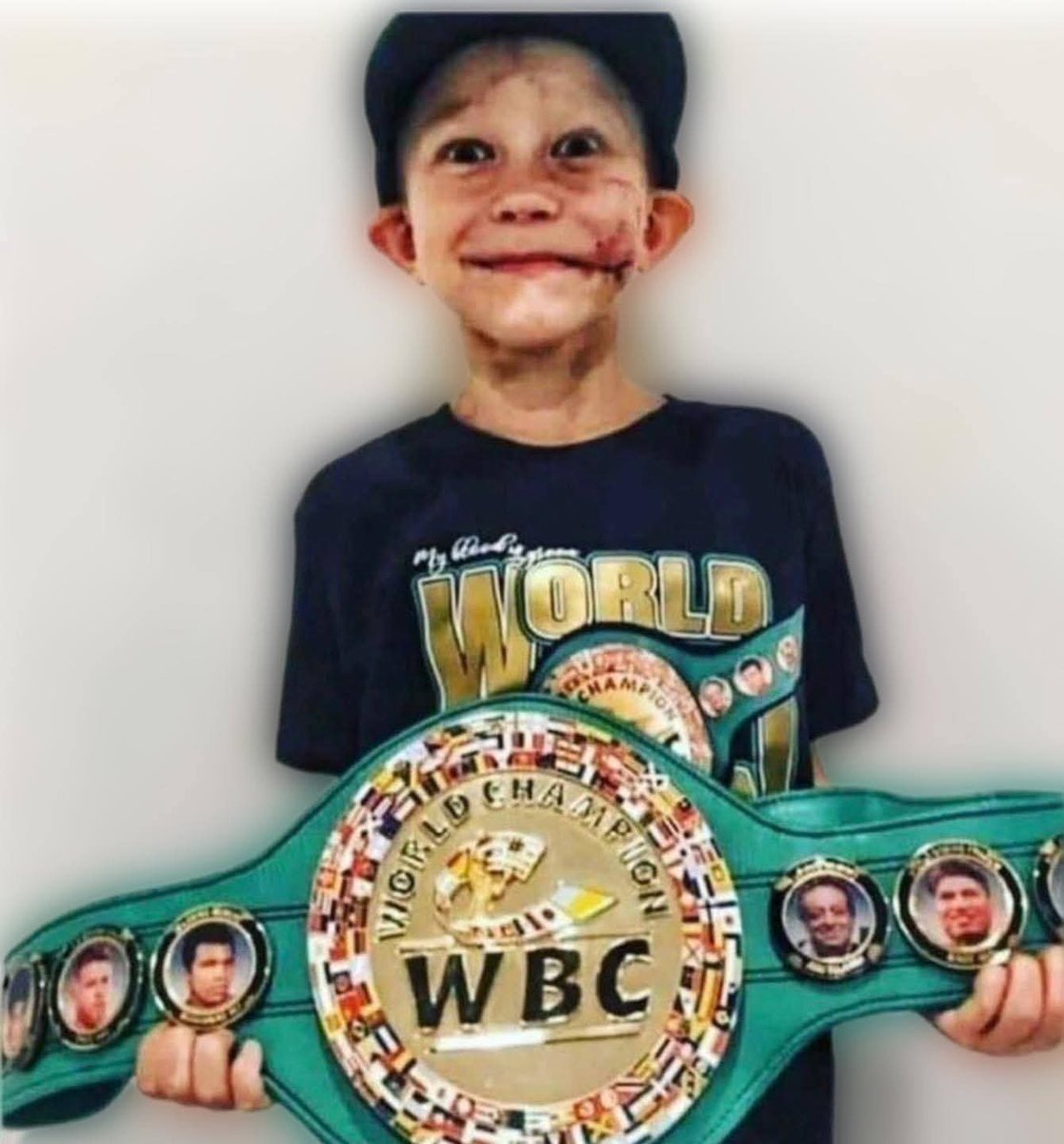 Mr_Husky1's tweet photo. Bridger Walker is the boy who saved his little sister from a vicious dog attack.

He took ninety stitches across his body, but he saved his three-year-old sister from what could have been certain death.

When asked why he did it, Bridger said:

“If someone was going to die, it must be me. I’m the older brother.”

The World Boxing Council later recognized him as a World Heavyweight Champion for a day, and his name will remain in the official historical record of the WBC.

For that one day, this little boy was the best fighter in the world.