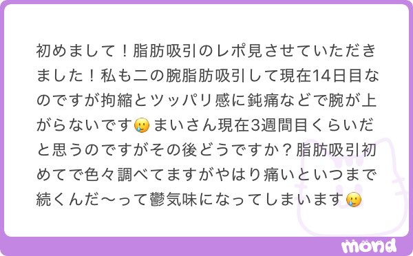 msarang_'s tweet photo. 脂肪吸引お疲れ様です！🥺✨
私もDT鬱ですが一緒に頑張りましょ😭✨

二の腕脂肪吸引 DT 3週間

拘縮・ツッパリ有
肘の部分伸ばすと痛い(筋肉痛みたいな感じ)
肘周辺がとにかく固い
脳天まで手届くがバンザイはまだ難しい&amp;後ろで腕は組めない
DT2週間の時ほど痛くないし、生活困難ではない🙆‍♀️ https://t.co/Yx9X0QZIAS