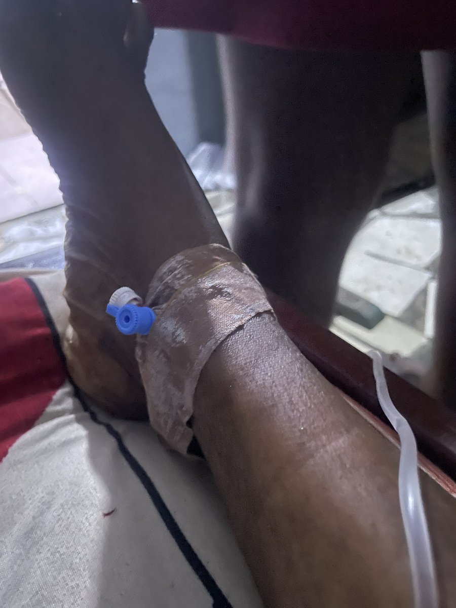 Aramide44936320's tweet photo. Chronicle of a sickle cell disease. The one that cause me pain now and then.😭

I need you all support. 
2284163176
Zenith Bank 
Bamimosu Mariam 
Thank you so much 🙏 https://t.co/iVfuy8qnt1