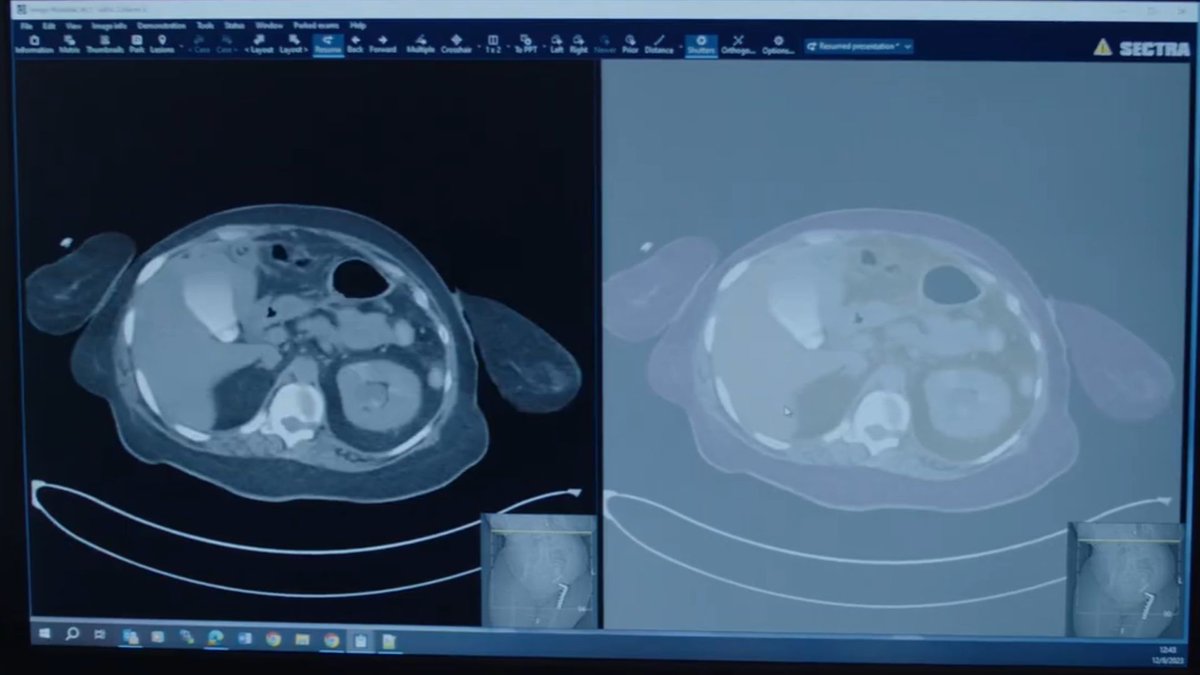 Technical_ly's tweet photo. AI technologies that help doctors improve medical imaging processes https://t.co/QYHCGtT7Qt https://t.co/YM9fblUhNz