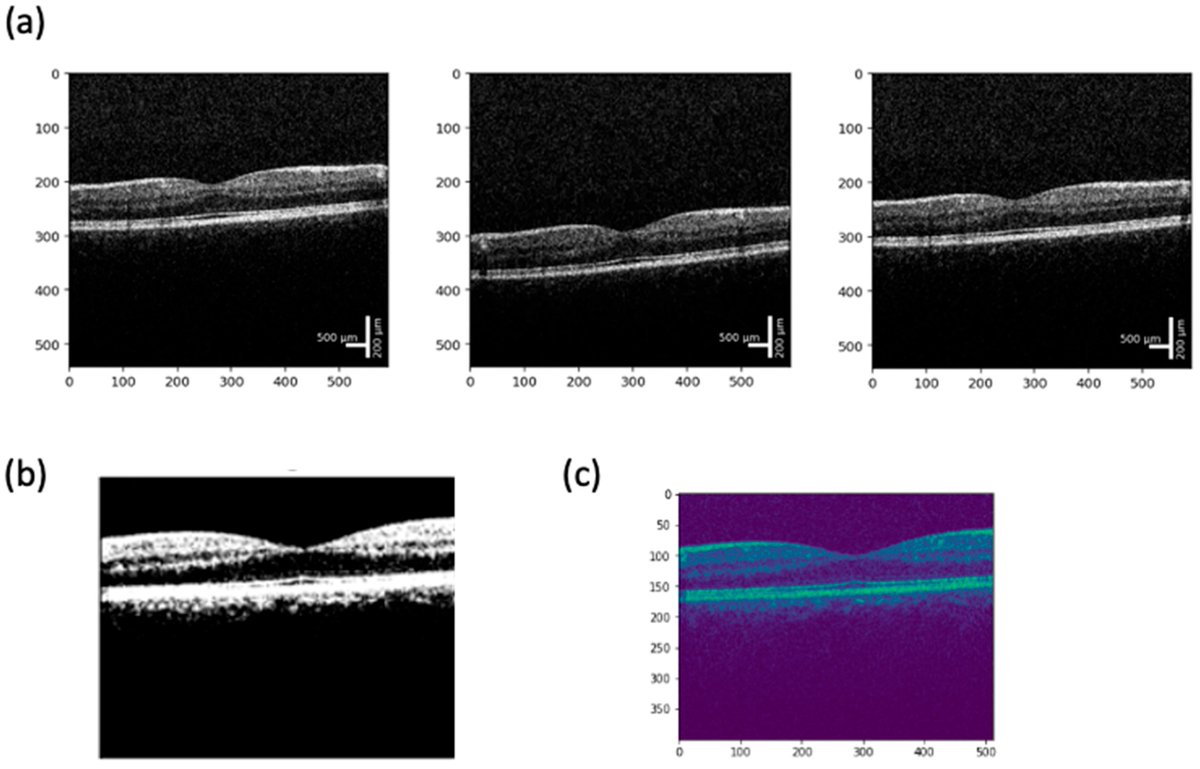 Bioeng_MDPI's tweet photo. 💥Excited for the publication: "Recent Optical Coherence Tomography (OCT) Innovations for Increased Accessibility and Remote Surveillance"
🔗https://t.co/KVAYpz6Tmg
📌 #Ophthalmology #RetinalImaging #MedicalImaging #AIinHealthcare #BiomedicalEngineering https://t.co/Ep4rHS2Mq2