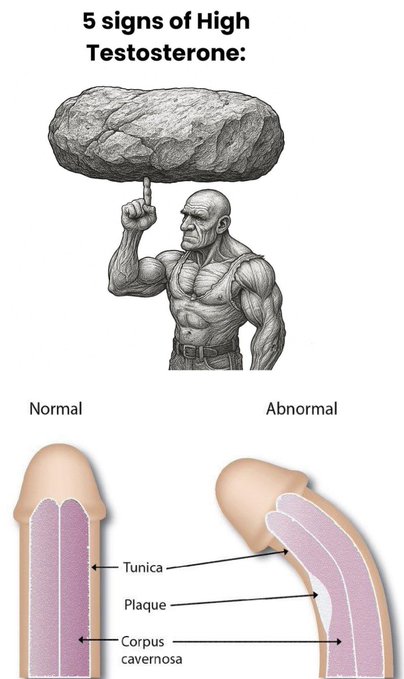 BrutalMindset's tweet photo. 5 Signs of High Testosterone:

- Thread - https://t.co/davpeLEokQ