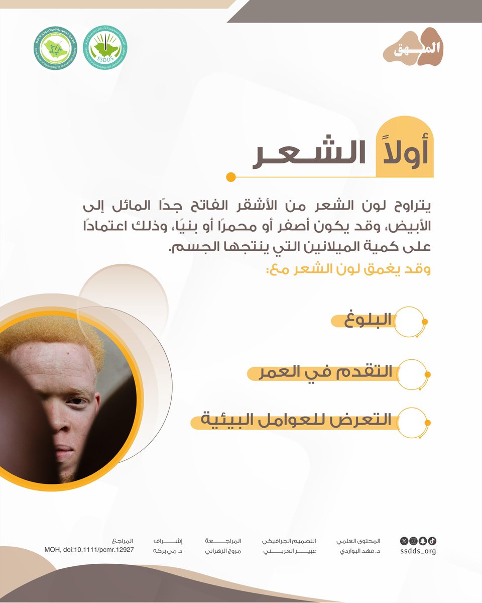 ssdds_org's tweet photo. ما هي علامات وأعراض المهق؟ المهق اضطراب وراثي يؤثر على صبغة الجلد والشعر والعينين، فيظهر عادةً على شكل بشرة شاحبة، وشعر وعيون فاتحة اللون. وقد تصاحبها اضطرابات بصرية مثل حساسية الضوء وضعف الإبصار. تهدف هذه السلسلة إلى توضيح الحقائق العلمية حول اضطراب المهق وتصحيح المفاهيم الخاطئة. 🤎

#المهق
#اليوم_العالمي_للمهق
#albinism
#albinismawareness
#الجمعية_السعودية_لأمراض_وجراحة_الجلد