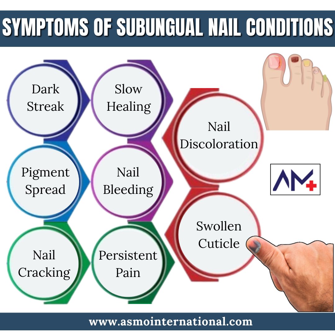 ashimamunjal05's tweet photo. Symptoms of Subungual Nail Conditions
.
https://t.co/9yLJI3L2y1
.
#SubungualCondition #NailHealth #NailDisorders #HealthyNails #NailCare #NailInfection #NailChanges #NailPain #NailDisease #ToenailHealth #healthcare #asmointernational #asmohealth #asmomedicines #asmocare https://t.co/CJ5litdmi6