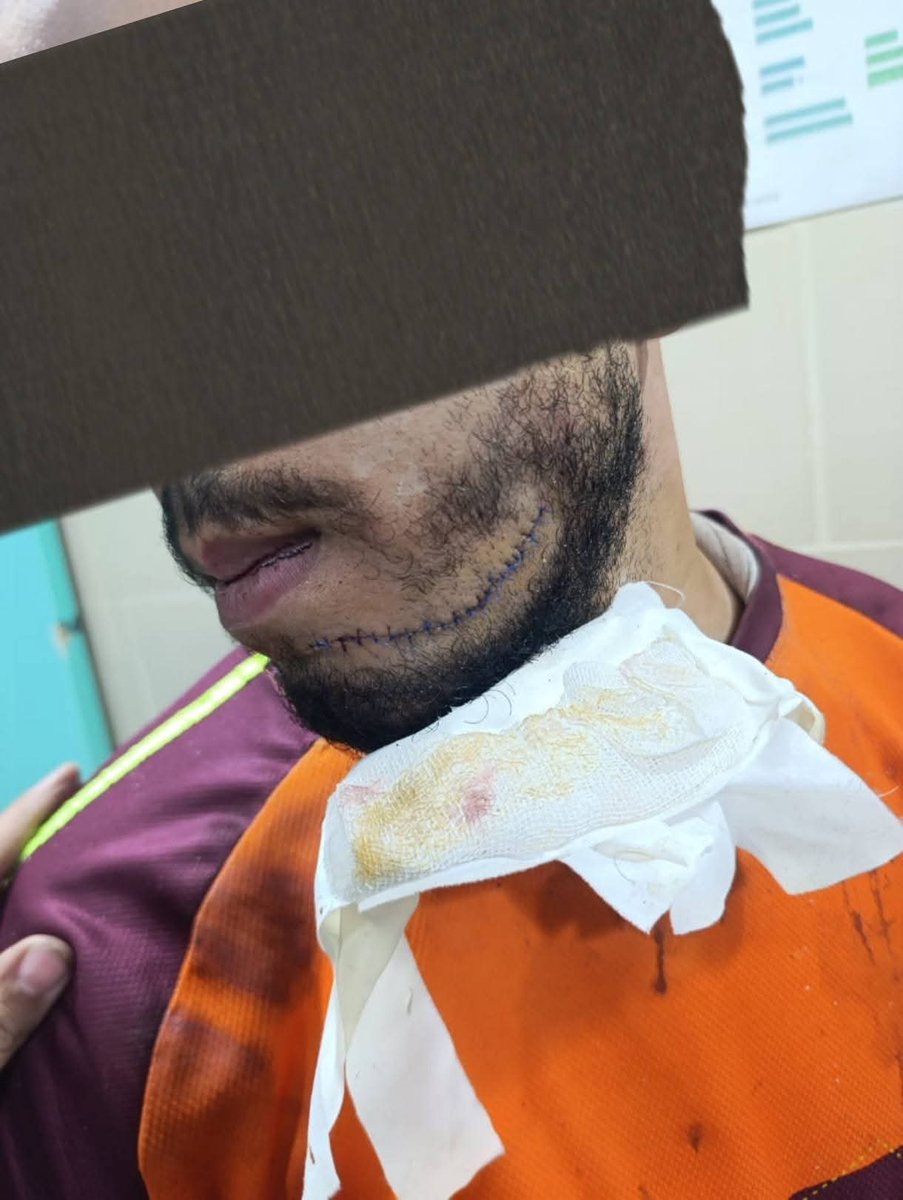arabmemesss's tweet photo. السلام عليكم ورحمة الله وبركاته 
انا أسمي كريم و شغال ف طليات زون حدائق القبه 
يوم ٢٩/٥/٢٠٢٦ الساعه 2 بليل جالي اوردر من مطعم اتشيكن مور الي ف امتداد ولي العهد بجوار حمزاوي https://t.co/rdBK6Gxjdw